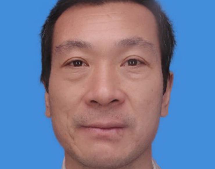 金豆